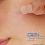 Imagen de Parches Control de Imperfecciones Cerave 22 u